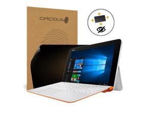 Celicious Privacy Plus ASUS Transformer Mini T102HA 4-Way Visual Black Out Screen Protector Celicious Privacy Plus ASUS Transformer Mini T102HA 4-Way Visual Black Out Screen Protector