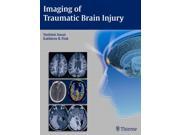 Imaging Of Traumatic Brain Injury 1