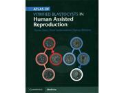 Atlas Of Vitrified Blastocysts In Human Assisted Reproduction 1