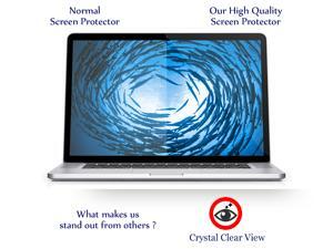 15" Anti-Glare Screen Protector Compatible w/ Macbook Pro 15.4" Retina Display A1398 15" Anti-Glare Screen Protector Compatible w/ Macbook Pro 15.4" Retina Display A1398