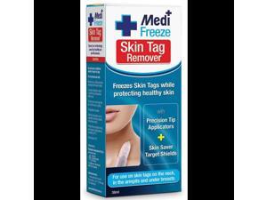 Medi Freeze Skin Tag Remover 38mL Medi Freeze Skin Tag Remover 38mL