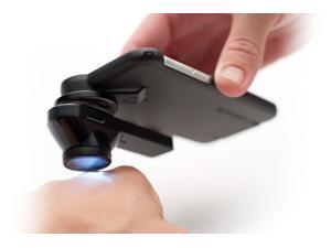 3GEN DL1 Basic Epiluminescence Dermlite Dermatoscope 3GEN DL1 Basic Epiluminescence Dermlite Dermatoscope