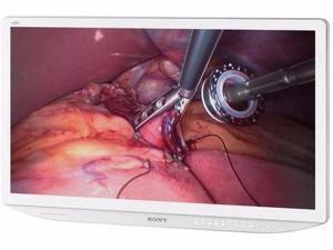 31-INCH 4K MEDICAL DISPLAY - LMDX310MD 31-INCH 4K MEDICAL DISPLAY - LMDX310MD