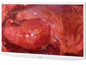 55-INCH 4K MEDICAL DISPLAY - LMDX550MD 55-INCH 4K MEDICAL DISPLAY - LMDX550MD