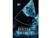 Birth Defects Opposing Viewpoints