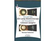 Text and Atlas Slit Lamp Biomicroscopy for Assessment in Cataract Surgery 1