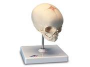 3B Scientific A26 Human Fetal Skull Anatomy Model 30 Weeks Mounted On Stand