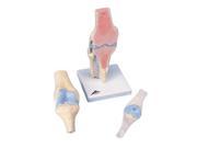 3B Scientific A89 Sectional Knee Joint Anatomy Model