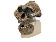3B Scientific VP755 1 Anthropological Skull Model Oldaway