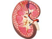 3B Scientific K10 Kidney Section Anatomy Model 3 Times
