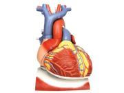 3B Scientific VD251 Heart On Diaphragm Anatomy Model 10 Parts