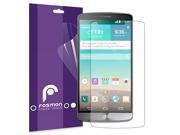 Fosmon Anti Glare Matte Screen Protector for LG G3 S Pack of 3