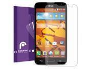 Fosmon Screen Protector for LG REALM Anti Glare 3 Pack