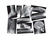 Roylco Inc. R 5914 Broken Bones X rays