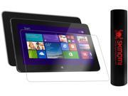 Skinomi Carbon Fiber Black Tablet Skin Screen Protector for Dell Venue 11 Pro