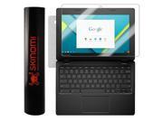 Skinomi® TechSkin - Lenovo Chromebook 100S Brushed Aluminum Full Body Skin with Free Lifetime Replacement / Front & Back Wrap Clear Film / Ultra HD and Anti-Bub Skinomi® TechSkin - Lenovo Chromebook 100S Brushed Aluminum Full Body Skin with Free Lifetime Replacement / Front & Back Wrap Clear Film / Ultra HD and Anti-Bub