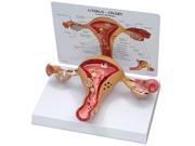 Anatomical Uterus Ovary Model with Pathologies