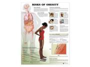 Risks of Obesity Anatomical Chart 20 x 26