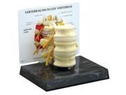 Anatomical Human 3 Piece L2 L3 L4 Vertebrae Model