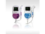 Pocket Fetal Doppler Baby Heart Beat Rate Monitor FHR 2Mhz Probe Pregnancy CE Ultrasonic Baby Heart monitor Sonoline C