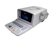 CMS600H Digital Portable B Ultrasound Diagnostic Imaging Scanner Machine