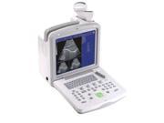 CMS600B 3 portable LCD screen B ultrasound diagnostic system