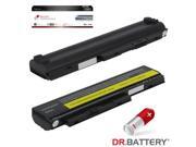 Dr Battery Advanced Pro Series: Laptop / Notebook Battery Replacement for Lenovo ThinkPad X220 Series (4400 mAh) 11.1 Volt Li-ion Advanced Pro Series Laptop Bat Dr Battery Advanced Pro Series: Laptop / Notebook Battery Replacement for Lenovo ThinkPad X220 Series (4400 mAh) 11.1 Volt Li-ion Advanced Pro Series Laptop Bat