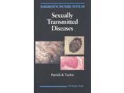Diagnostic Picture Tests In Sexually Transmitted Diseases