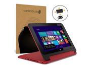 Celicious Privacy Plus HP Pavilion x360 11 [4 Way] Filter Screen Protector