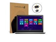 Celicious Privacy Plus Dell Inspiron 14 5455 [4 Way] Filter Screen Protector