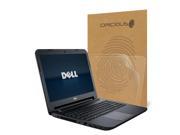 Celicious Matte Dell Inspiron 14 3421 Anti Glare Screen Protector [Pack of 2]