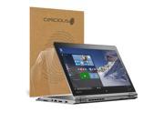 Celicious Vivid Lenovo ThinkPad Yoga 460 Crystal Clear Screen Protector [Pack of 2]