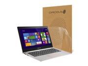 Celicious Vivid ASUS ZenBook UX303LB Crystal Clear Screen Protector [Pack of 2]