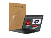 Celicious Impact HP ZBook 15u G3 Anti Shock Screen Protector