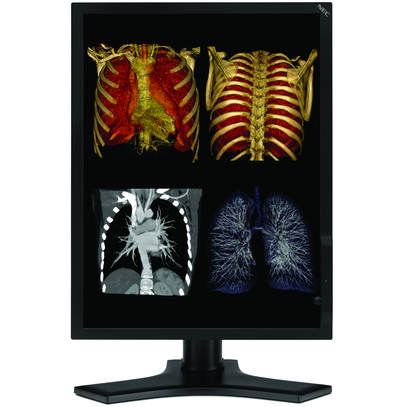 NEC Display Solutions MD213MC Black 21.3" 12ms(GTG) Tilt,Swivel & Height Adjustable Stand  LCD Monitor for Medical Professionals 400 cd/m2 750:1 